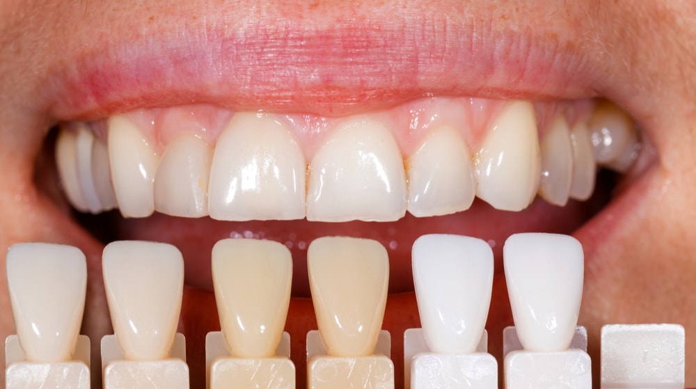Dr Dent Teeth Whitening Strips